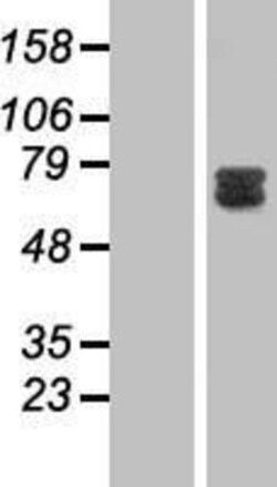 Novus Biologicals&trade;&nbsp;GAB2 Overexpression Lysate