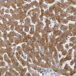 GAB3 Antibody, Novus Biologicals 0.1 mL | Buy Online | Novus Biologicals | Fisher Scientific