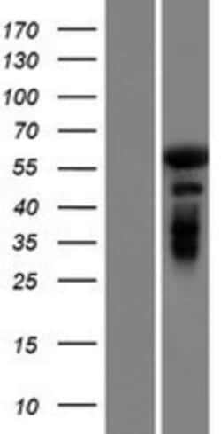 Novus Biologicals™ GAB4 Overexpression Lysate