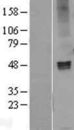 Novus Biologicals&trade;&nbsp;GABA-AR alpha 1 Overexpression Lysate