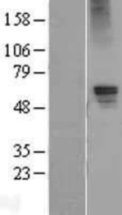 Novus Biologicals&trade;&nbsp;GABA-AR alpha 5 Overexpression Lysate