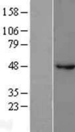 Novus Biologicals™ GABA-A R beta 1 Overexpression Lysate