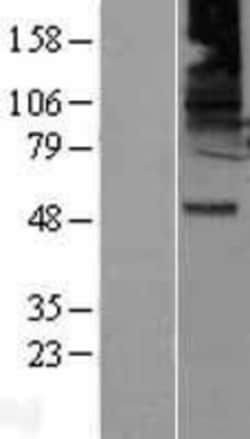 Novus Biologicals&trade;&nbsp;GABA-A R beta 2 Overexpression Lysate