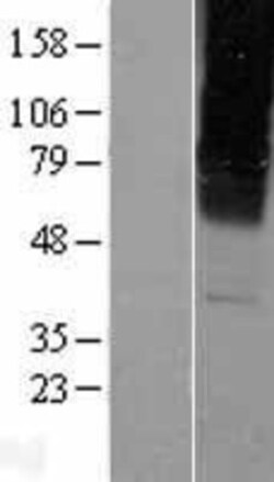 Novus Biologicals™ GABA-A R gamma 2 Overexpression Lysate