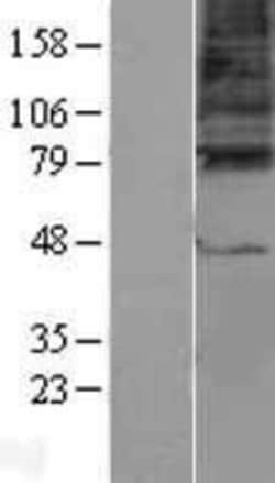 Novus Biologicals&trade;&nbsp;GABA-A R gamma 3 Overexpression Lysate