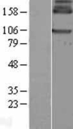 Novus Biologicals&trade;&nbsp;GABA-B R1 Overexpression Lysate