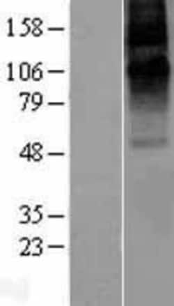 Novus Biologicals™ GABA Receptor Epsilon Overexpression Lysate