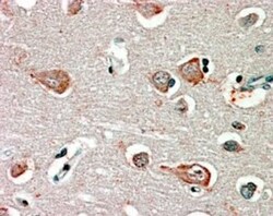 GABA-A R beta 3 Antibody, Novus Biologicals 0.1mg; Unlabeled:Antibodies,