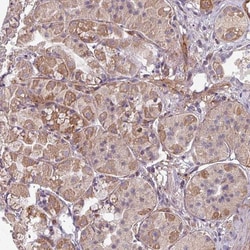 GABARAPL1 Antibody, Novus Biologicals:Antibodies:Primary Antibodies