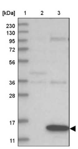 GATE-16/GABARAPL2 Antibody, Novus Biologicals 0.1mL; Unlabeled:Antibodies,
