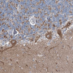 GATE-16/GABARAPL2 Antibody, Novus Biologicals 0.1mL; Unlabeled:Antibodies,