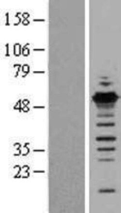Novus Biologicals&trade;&nbsp;GABPB1 Overexpression Lysate