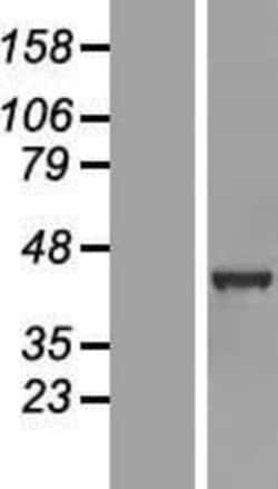 Novus Biologicals&trade;&nbsp;GABPB1 Overexpression Lysate