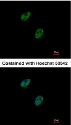 Gabpb2 Antibody, Novus Biologicals 0.1mL; Unlabeled:Antibodies, Polyclonal