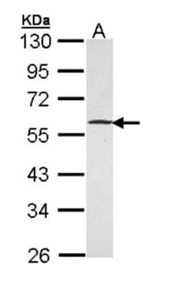 Gabpb2 Antibody, Novus Biologicals 0.1mL; Unlabeled:Antibodies, Polyclonal