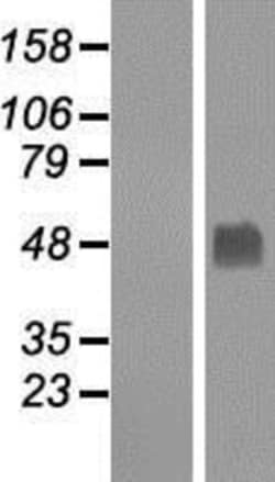 Novus Biologicals&trade;&nbsp;Gabpb2 Overexpression Lysate