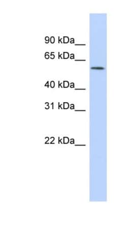 GABA-A R rho 1 Antibody, Novus Biologicals 100&mu;L; Unlabeled:Antibodies,
