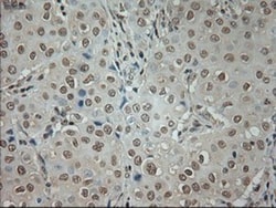 GAD1/GAD67 Antibody (OTI3G9), Novus Biologicals 0.1mL; Unlabeled:Antibodies,