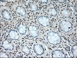 GAD1/GAD67 Antibody (OTI3G9), Novus Biologicals 0.1mL; Unlabeled:Antibodies,