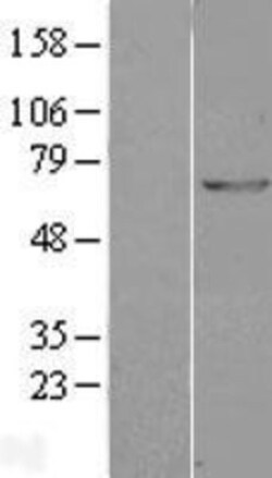 Novus Biologicals&trade;&nbsp;GAD1/GAD67 Overexpression Lysate