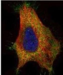 GAD2/GAD65 Antibody, Novus Biologicals 0.1mg; Unlabeled:Antibodies, Polyclonal