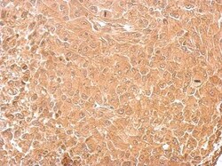 GAD2/GAD65 Antibody, Novus Biologicals 0.1mg; Unlabeled:Antibodies, Polyclonal
