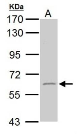 GAD2/GAD65 Antibody, Novus Biologicals 0.1mg; Unlabeled:Antibodies, Polyclonal