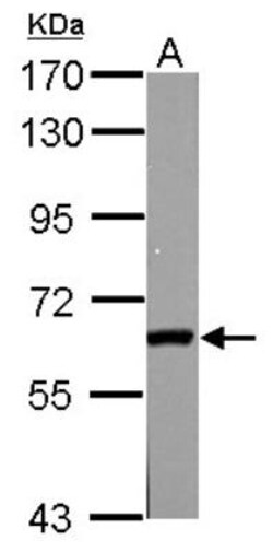 GAD2/GAD65 Antibody, Novus Biologicals 0.1mg; Unlabeled:Antibodies, Polyclonal