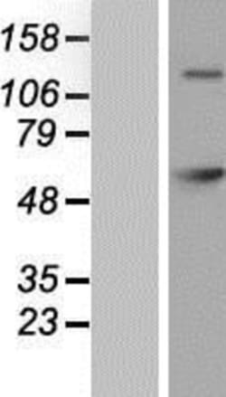 Novus Biologicals&trade;&nbsp;GAD2/GAD65 Overexpression Lysate