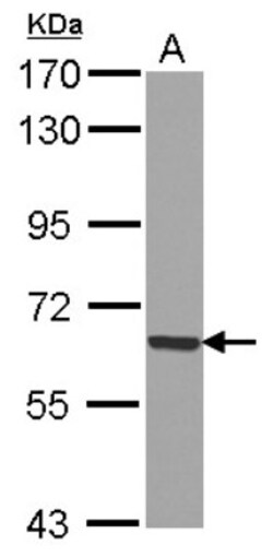 GADD34 Antibody, Novus Biologicals 0.1mL; Unlabeled:Antibodies, Polyclonal