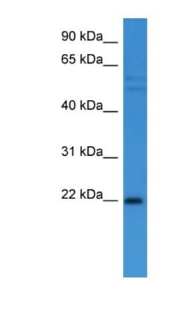 GADD45 alpha Antibody, Novus Biologicals 100&mu;L; Unlabeled:Antibodies,
