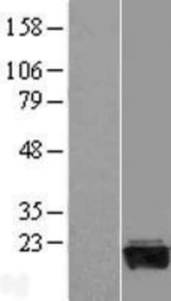 Novus Biologicals&trade;&nbsp;GADD45G Overexpression Lysate