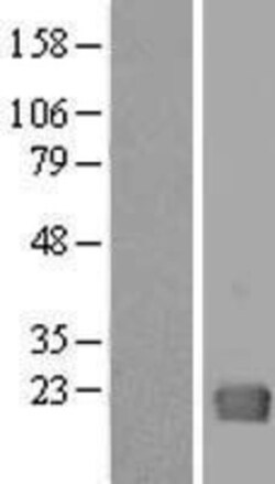 Novus Biologicals™ GAGE1 Overexpression Lysate