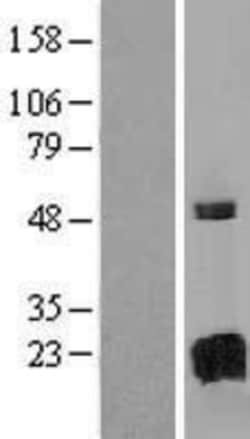 Novus Biologicals&trade;&nbsp;GAGE8 Overexpression Lysate