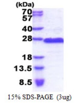 Novus Biologicals&trade;&nbsp;Recombinant Human GAGE8 His Protein