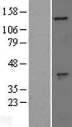 Novus Biologicals™ GAK Overexpression Lysate