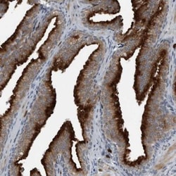 GAK Antibody, Novus Biologicals:Antibodies:Primary Antibodies