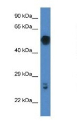 GAL3ST4 Antibody, Novus Biologicals 100 &mu;L | Buy Online | Novus Biologicals | Fisher Scientific