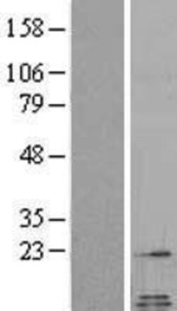 Novus Biologicals&trade;&nbsp;Galanin Overexpression Lysate