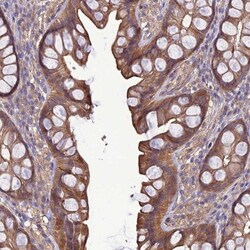 Galanin R2/GALR2 Antibody, Novus Biologicals 0.1mL; Unlabeled:Antibodies,