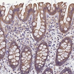 Galanin R2/GALR2 Antibody, Novus Biologicals 0.1mL; Unlabeled:Antibodies,