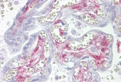 Galectin-1 Antibody, Novus Biologicals 0.05mg; Unlabeled:Antibodies, Polyclonal