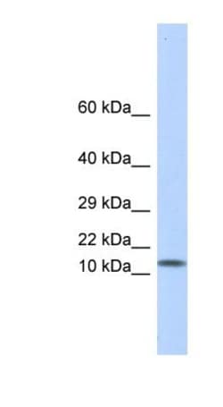 Galectin-1 Antibody, Novus Biologicals 0.05mg; Unlabeled:Antibodies, Polyclonal