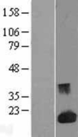 Novus Biologicals&trade;&nbsp;Galectin-1 Overexpression Lysate