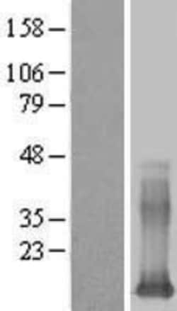 Novus Biologicals&trade;&nbsp;Galectin 13 Overexpression Lysate