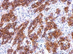 Galectin-4 Antibody, Novus Biologicals 0.1mL; Unlabeled:Antibodies, Polyclonal