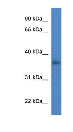 Galectin-4 Antibody, Novus Biologicals:Antibodies:Primary Antibodies