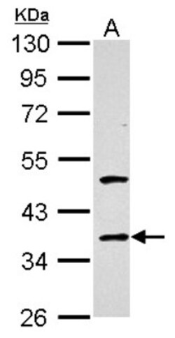 Galectin-4 Antibody, Novus Biologicals 0.1mL; Unlabeled:Antibodies, Polyclonal