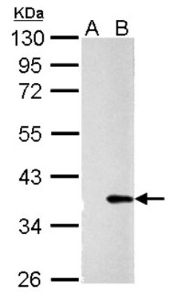Galectin-4 Antibody, Novus Biologicals 0.1mL; Unlabeled:Antibodies, Polyclonal