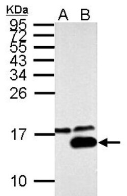 Galectin-7 Antibody, Novus Biologicals 0.1mL; Unlabeled:Antibodies, Polyclonal